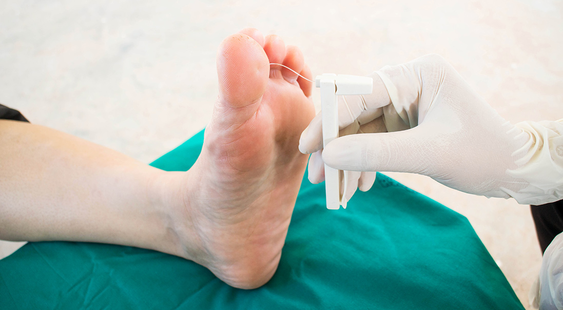 How Do Doctors Test For Diabetic Neuropathy